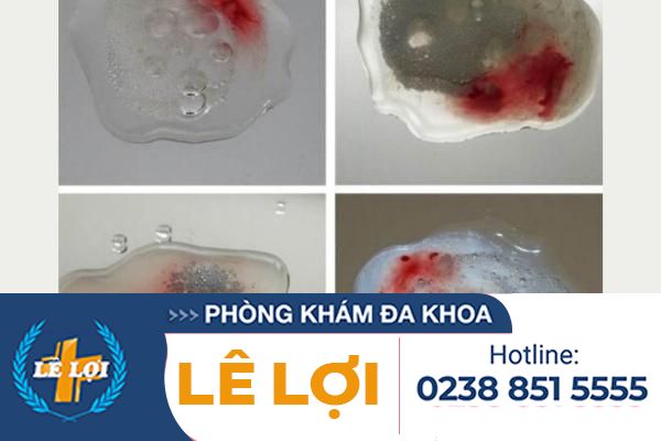 Tinh-trung-co-mau-do-bat-thuong